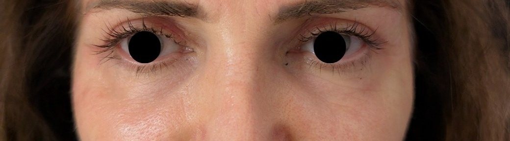 Close-up of eyes after