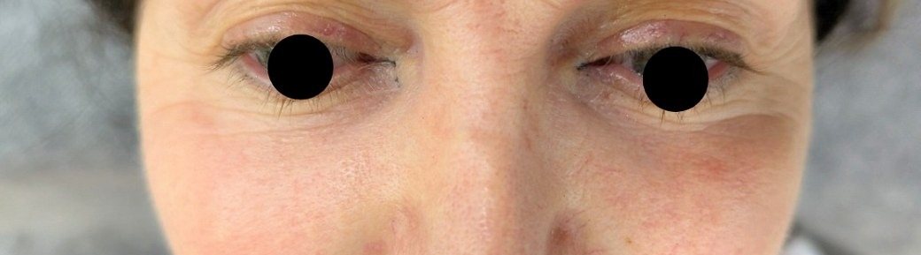 Close-up of eyes before